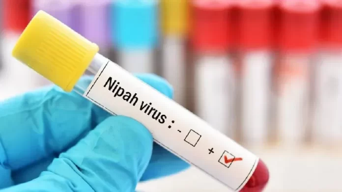 Nipah Virus Nipah Virus